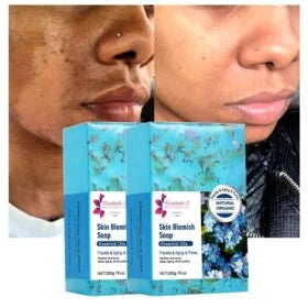 Blemish Care Soap- 200g